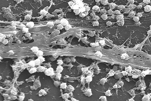 Biophysics: Biofilms, Diffusion, & Antibiotics