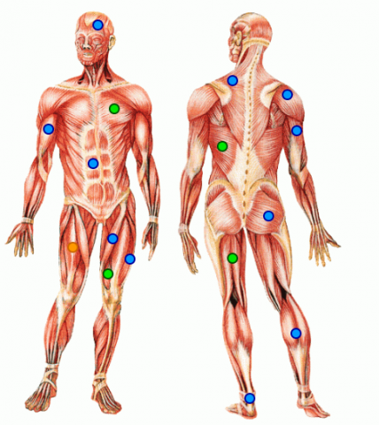 Muscle Lesson 